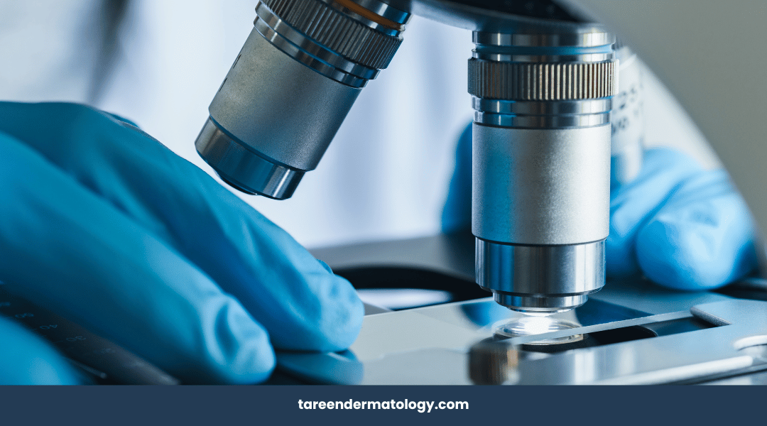 Dermatologist examining tissue under a microscope during Mohs surgery to detect and remove skin cancer cells.